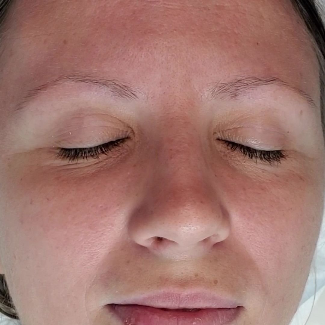 micropimentacion cejas antes