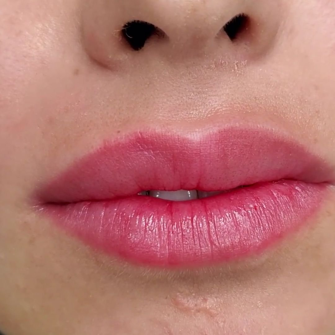 micropimentacion labios orihuela