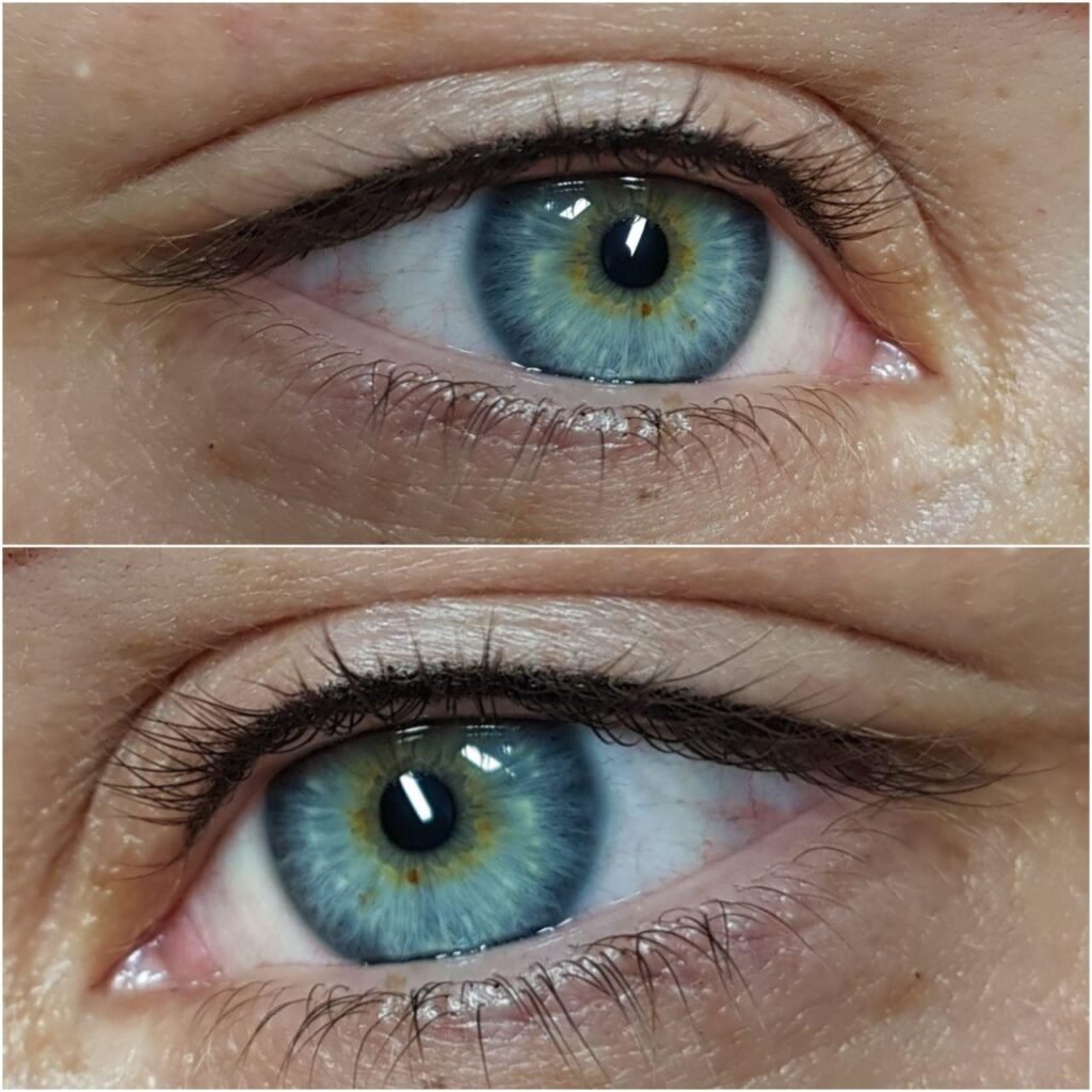 micropimentacion ojos